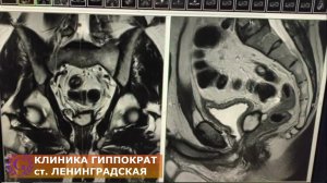 МРТ ПРОСТАТЫ. Что мы видим?