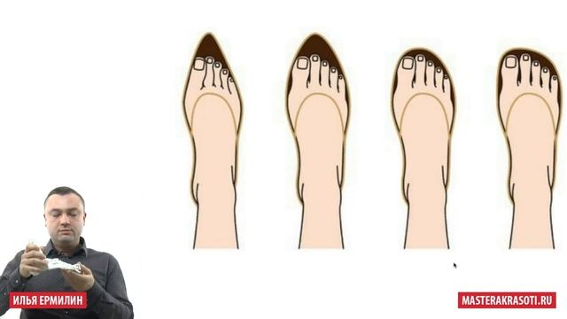 Молоткообразная деформация пальцев. Фрагмент вебинара "Педикюр при онихолизисе". Илья Ермилин смотреть онлайн