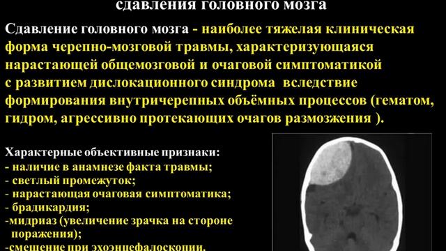 Закрытая травма черепа и головного мозга СГМУ смотреть онлайн