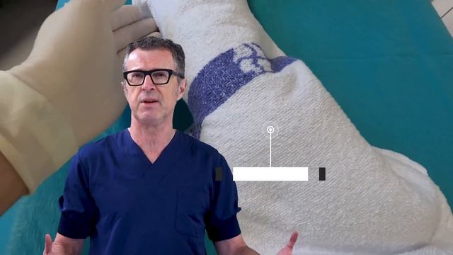 Difficult Intravenous (IV) cannulation #2: Triple Tourniquet Technique смотреть онлайн