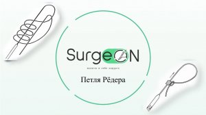 Техника выполнения петли Рёдера
