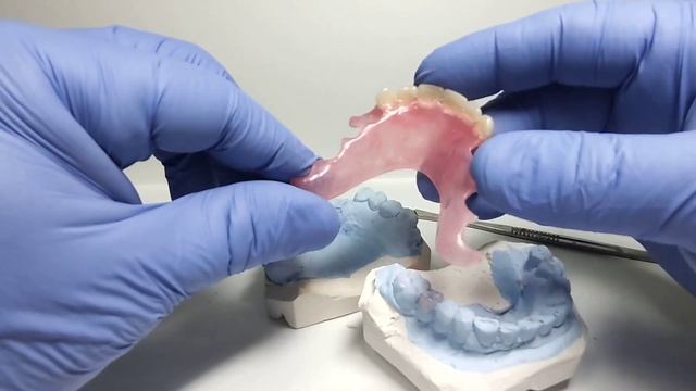 Вместо акрилового протеза термопласт☝ смотреть онлайн