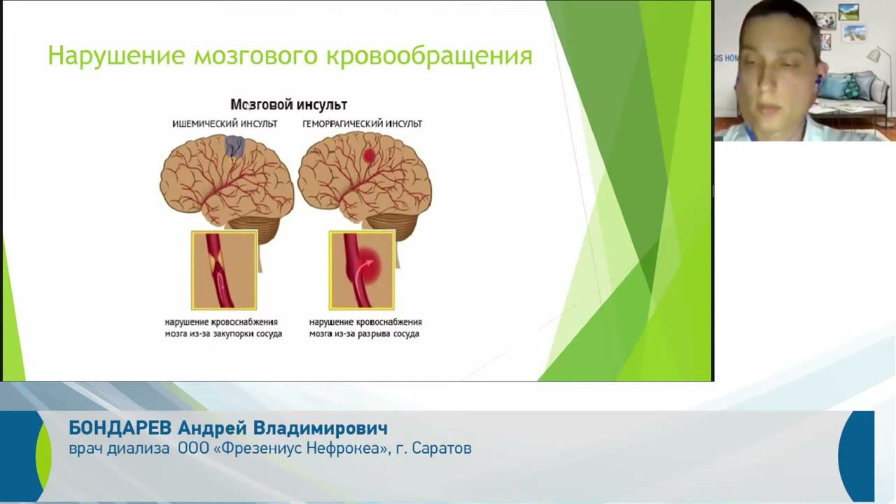 Артериальная гипертензия диализного пациента