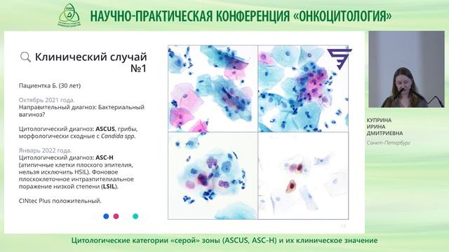 Цитологические категории «серой» зоны ASCUS, ASC H и их клиническое значение