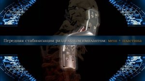 Хирургическая коррекция шейно-грудных деформаций позвоночника