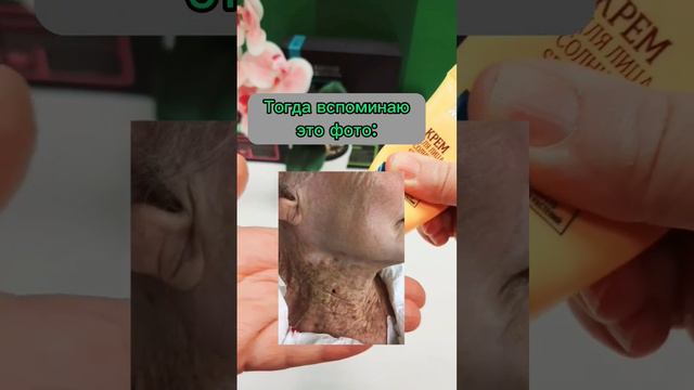 Что будет, если не защищать кожу от солнца смотреть онлайн