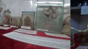 Коллекция Уродов Кунсткамера Музей Медецины  И Греха Жуткая Выставка