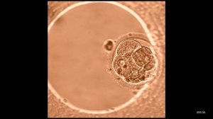 Развитие_эмбриона_с_момента_оплодотворения_in_vitro_и_до_5-6_дня_развития.mp4