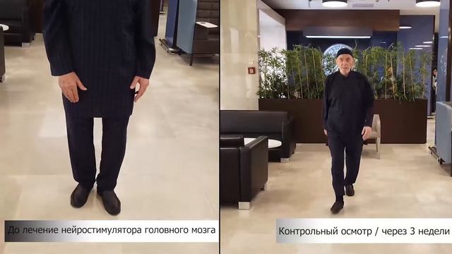 Adiljon ISAKHANOV / До и После Операции смотреть онлайн