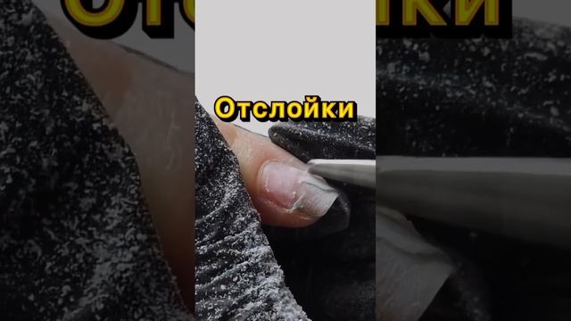 Ошибки, которые приводят к отслойкам смотреть онлайн