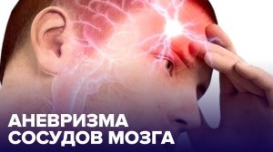 АНЕВРИЗМА сосудов мозга: чем ОПАСНА и как ее обнаружить