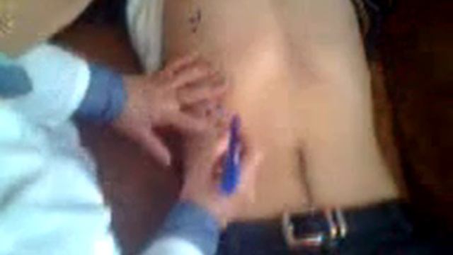 Jigar Perkussiyasi Жигар перкуссияси Перкуссия печени