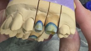 Создание колпачка