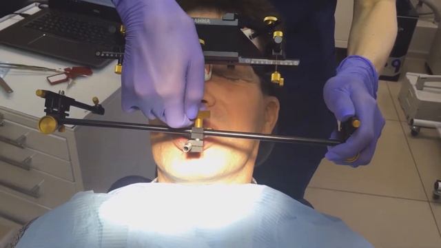 Авторская стоматологическая клиника "M-Denta". Работа гнатолога 2 смотреть онлайн