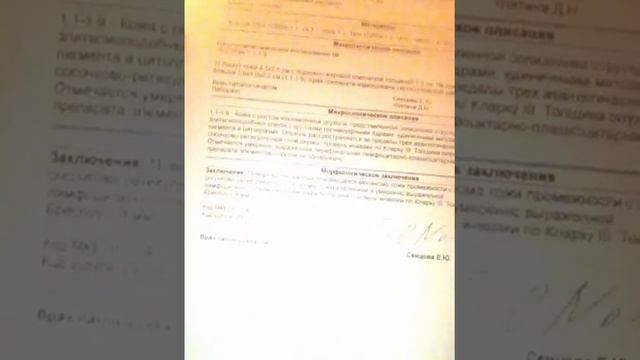 Меланома смотреть онлайн