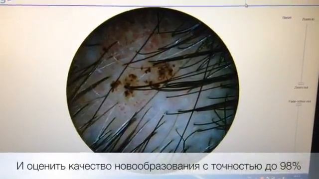 Диагностика родинок смотреть онлайн