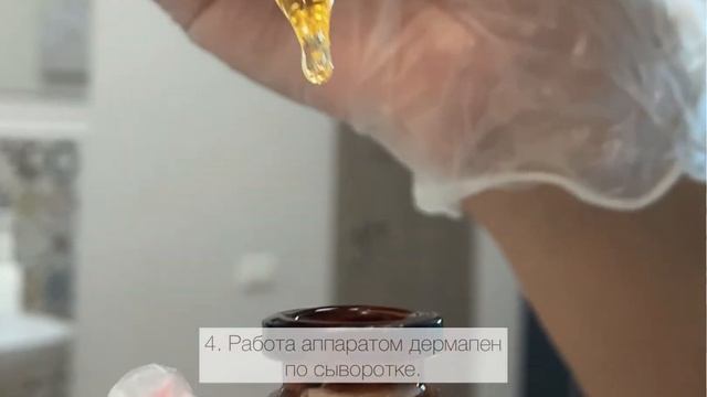 Микронидлинг в салоне ИНСИТИ г. Минск смотреть онлайн
