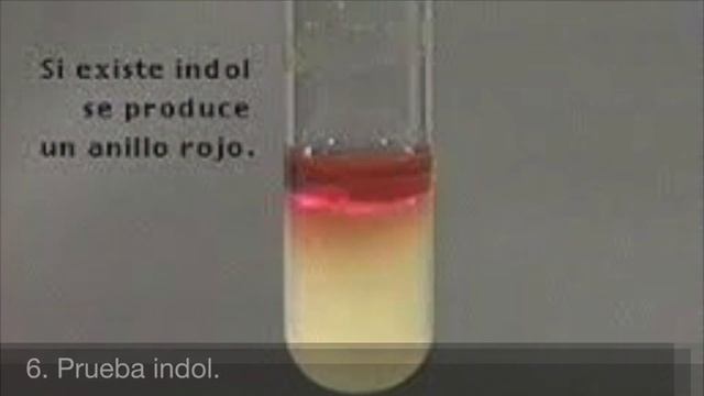 IDENTIFICACIÓN MICROORGANISMOS SOBREINFECTANTES Y CANDIDA ALBICANS смотреть онлайн