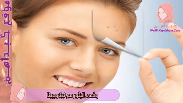 ودعي الرؤوس السوداء إلى الأبد مع نيتروجينا | منتجات نيتروجينا للتخلص من البثور نهائياً - كيداهم HD смотреть онлайн