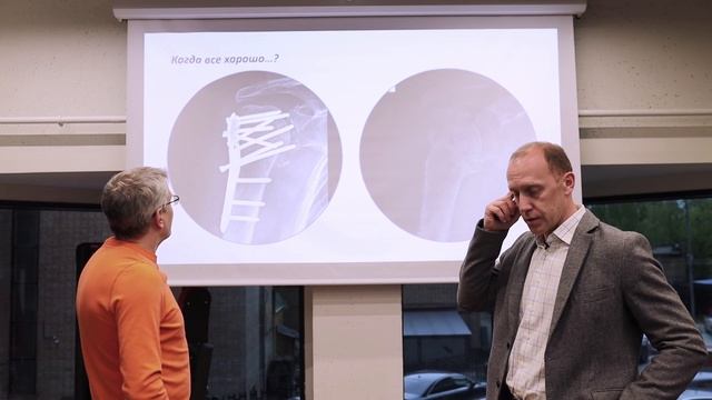 Переломы плечевой кости (проксимальный отдел) смотреть онлайн