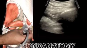 UG PIRIFORMIS INJECTION