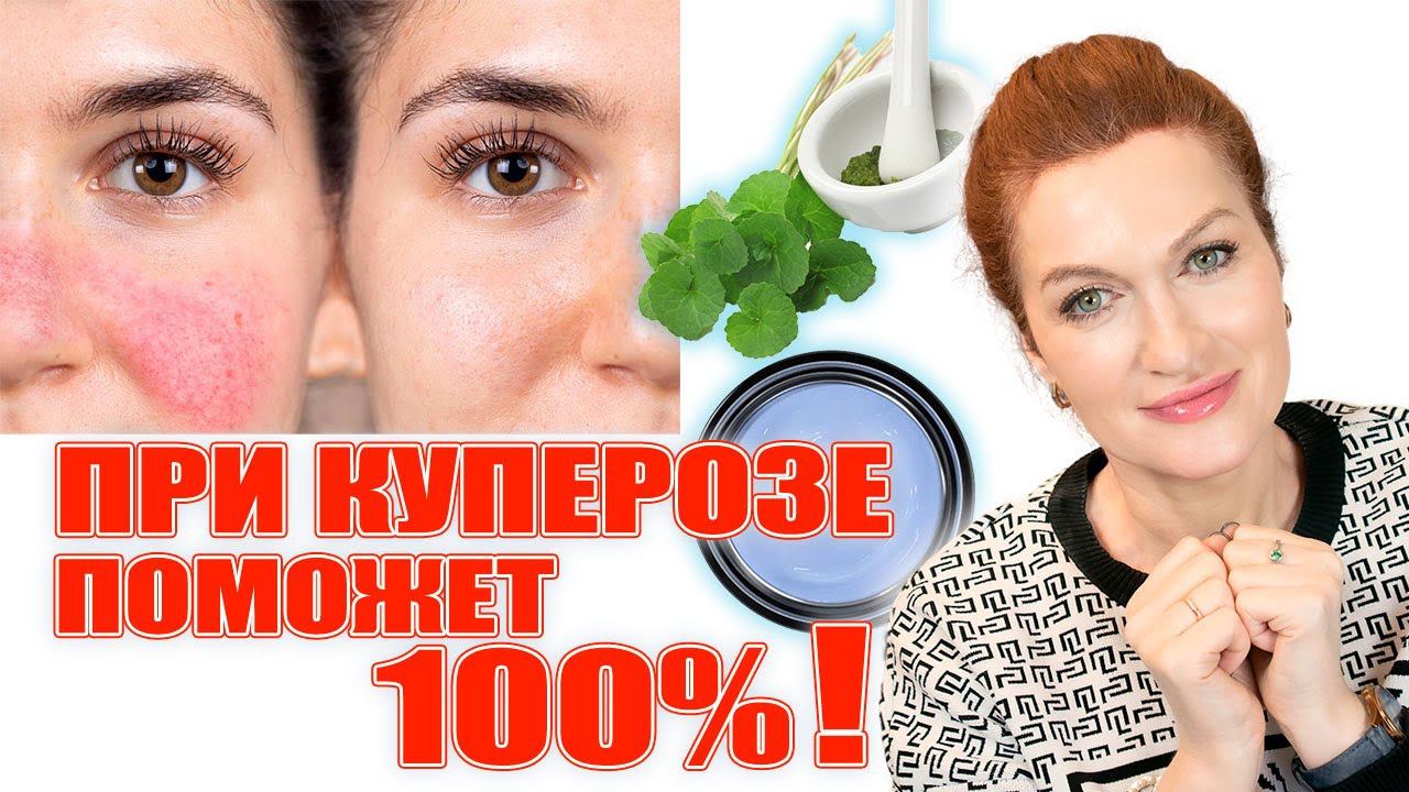 Гладкая, ровная по тону кожа по-корейски! Как добиться! смотреть онлайн