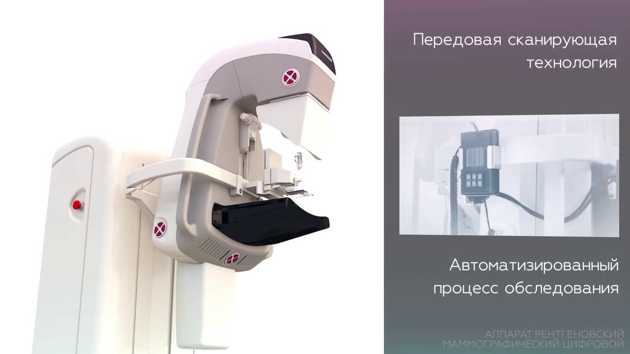 АДАНИ МАММОСКАН