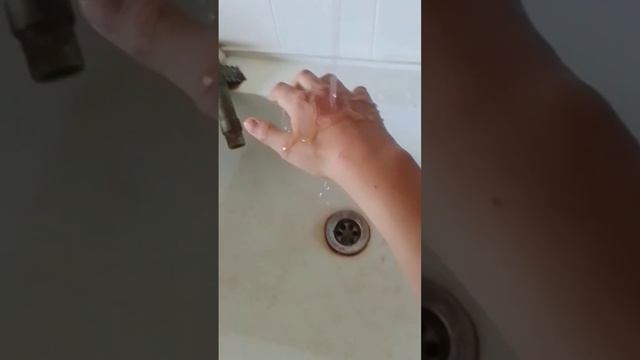 Что делать если вы получили ожог от воска смотреть онлайн