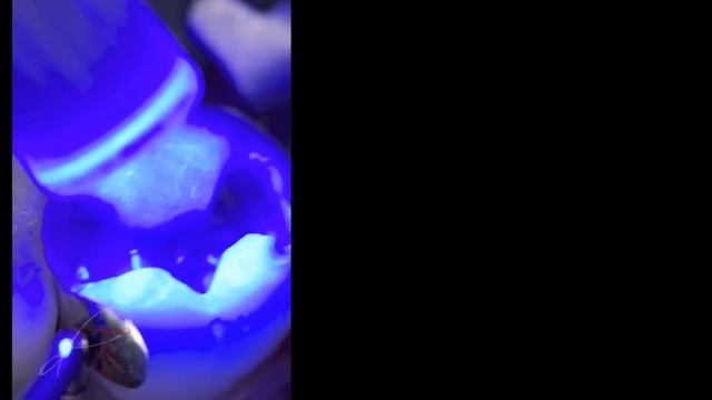G-ænial: Class II Restoration - Developing Contour, Color & Contact (Video) смотреть онлайн