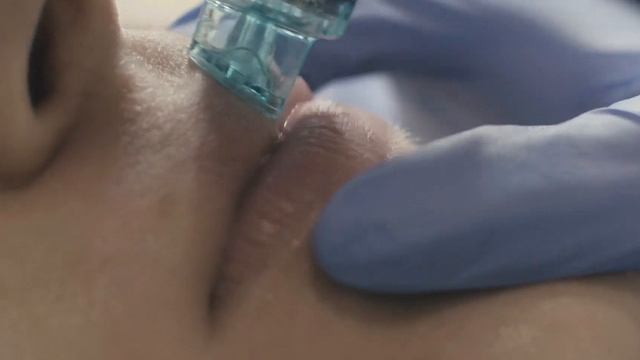 HYDRAFACIAL.  ВЫ ТОЧНО ГОТОВЫ ДАЛЬШЕ ТЕРПЕТЬ НЕСОВЕРШЕННУЮ КОЖУ?