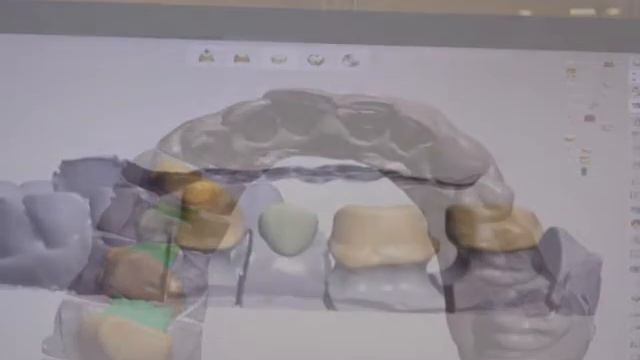Dentallabor In Athens_ 3 Shape D-900 & Ipression 5-S2_ Panos Chatiras смотреть онлайн