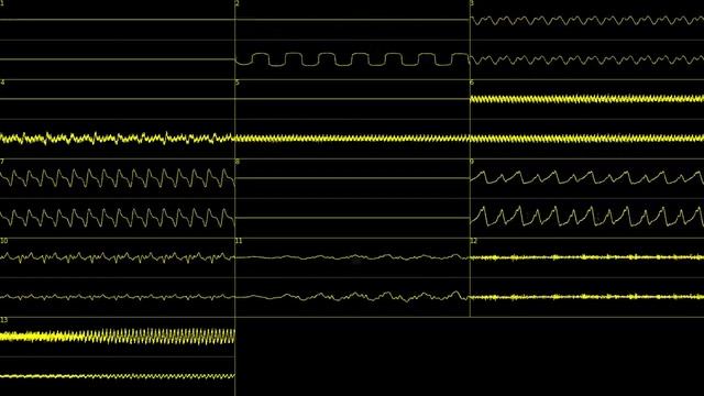 (Oscilloscope View) Bucky O'Hare - Asteroidbelt [YM2151+K054539] смотреть онлайн