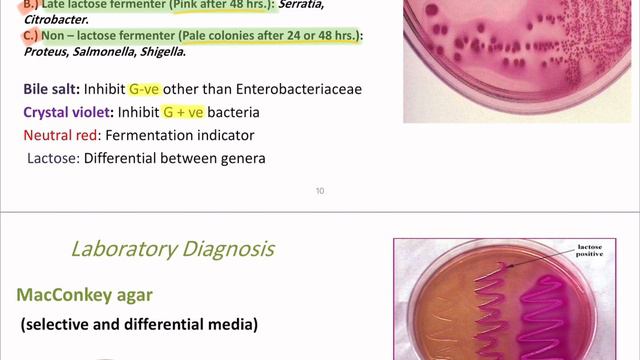Enterobacteriaceae(microbiology lab) смотреть онлайн