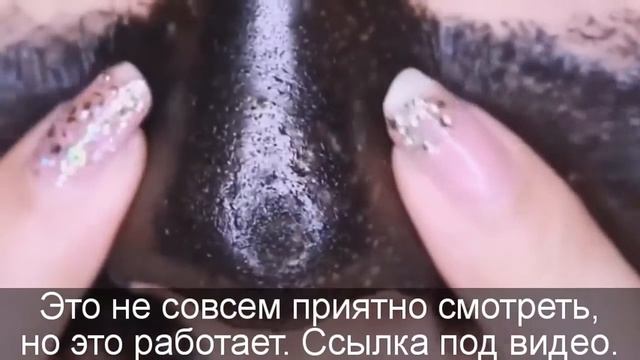 Как избавиться от прыщей на лице за неделю. Средство от прыщей и угревой сыпи. смотреть онлайн