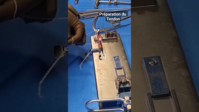 préparation du tendon semi-tendineux en 4 brins pour une ligamentoplastie LCA du genou смотреть онлайн