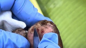 Ishmael’s painful small type of jiggers - watch five series of these and others @riseupsociety.net