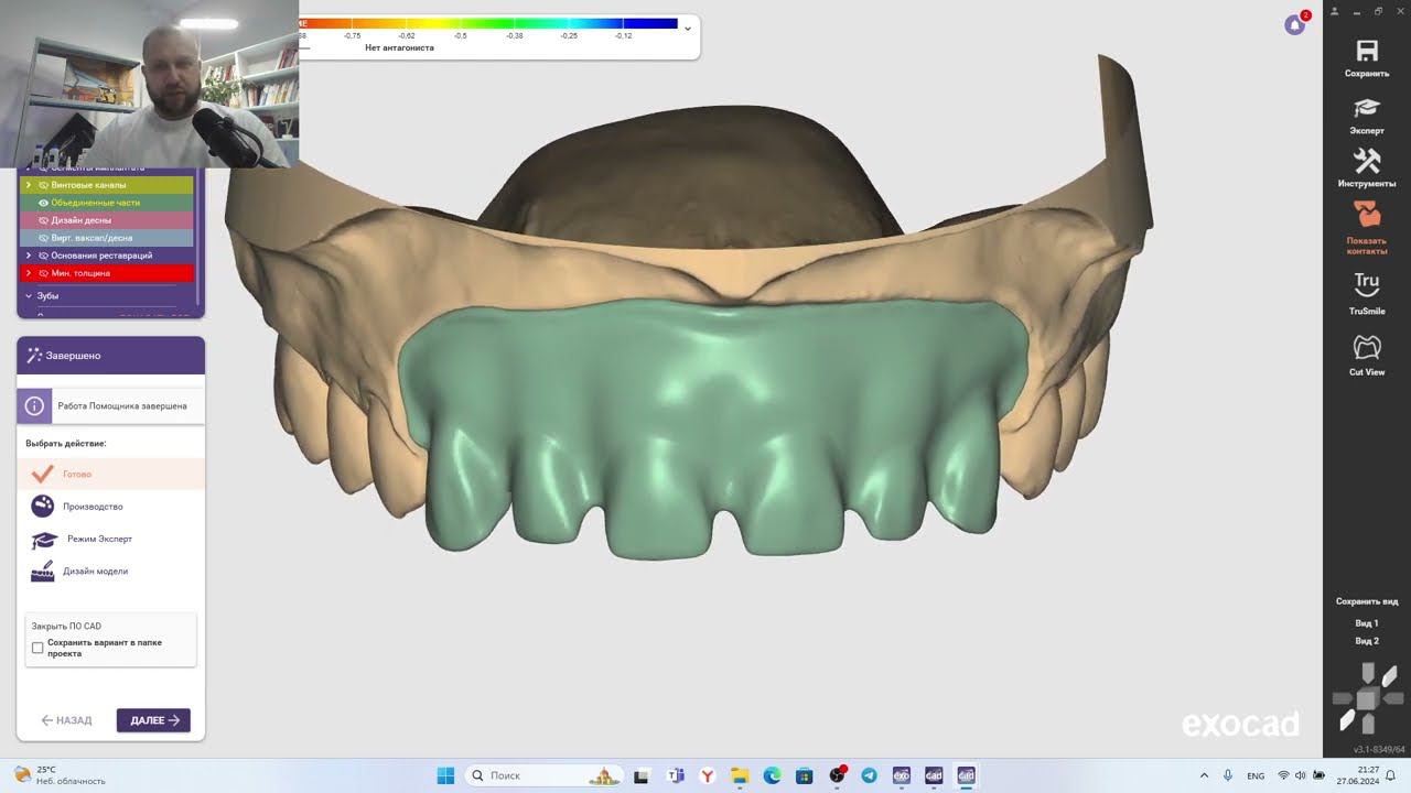 Летняя школа зубных техников, проверка домашнего задания. Как проходит обучение зубных техников смотреть онлайн