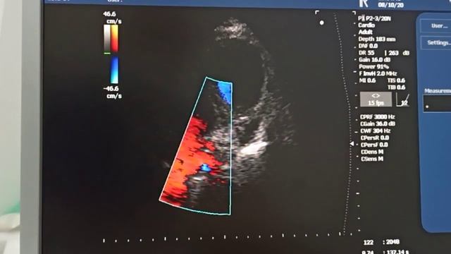 В чем причина одышки Вопрос смотреть онлайн