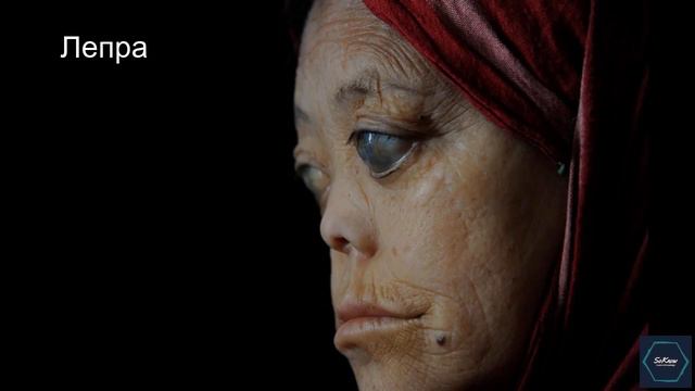 Лепра : Кто, что и где? | SoKnow смотреть онлайн