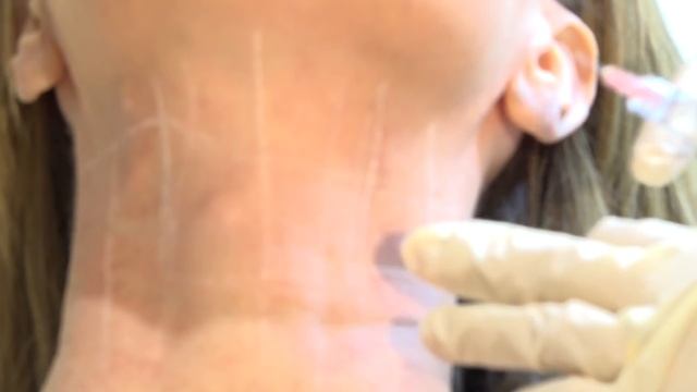 Introducing Profhilo The Airbrushed Look смотреть онлайн