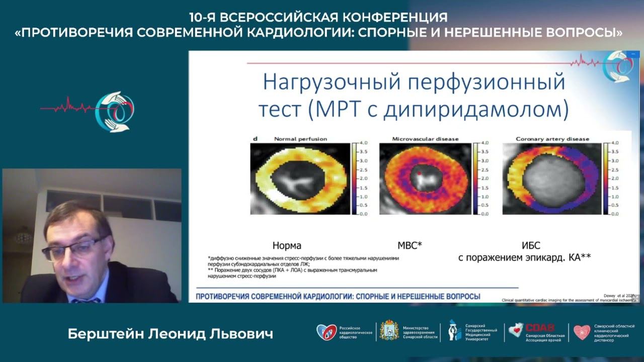 13 11 Научный Симпозиум Стабильная Ибс Краеугольные Моменты Ведения Пациента смотреть онлайн