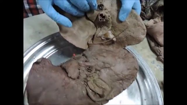GIT - Anatomy practical another view | Module 17 BY DR. Hazem Gamal смотреть онлайн