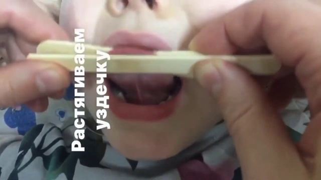 Как растянуть уздечку. logoped_stupenki смотреть онлайн