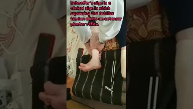 Pathological reflexes, Schaeffer's sign Патологические рефлексы, рефлекс Шеффера смотреть онлайн