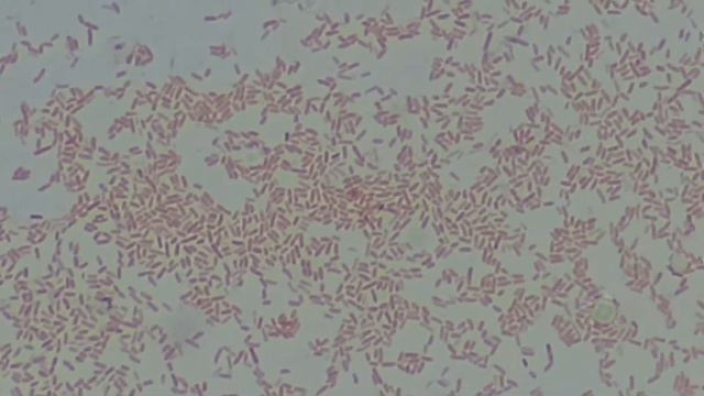 Common bacteria colony morphology and their Gram staining смотреть онлайн