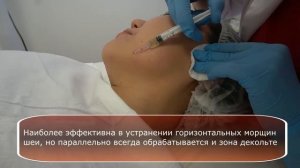Техника выполнения папульной мезотерапии