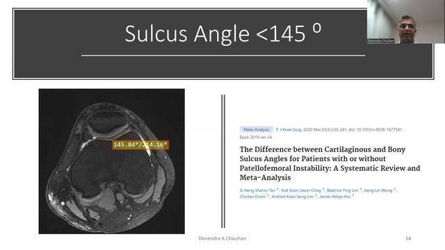 knee pain often underdiagnosed смотреть онлайн