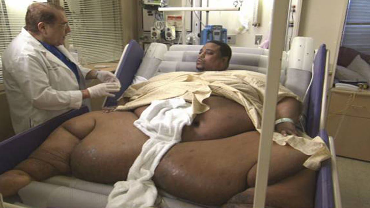 10 Самых ТОЛСТЫХ ЛЮДЕЙ в Мире смотреть онлайн