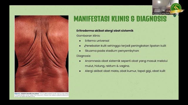 JURNAL READING REFERAT ERITRODERMA смотреть онлайн