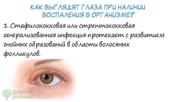 Внимание! 11 сигналов, при помощи которых глаза предупреждают о проблемах со здоровьем смотреть онлайн